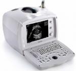 Sistem portabil de imagistica cu diagnosticare ultrasonica digitala DP-2200 PLUS