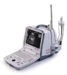 Sistem portabil de imagistica cu diagnosticare ultrasonica digitala DP-6600